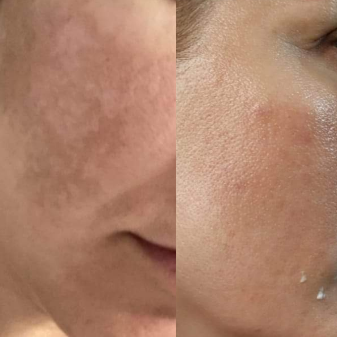 Before and after result 9