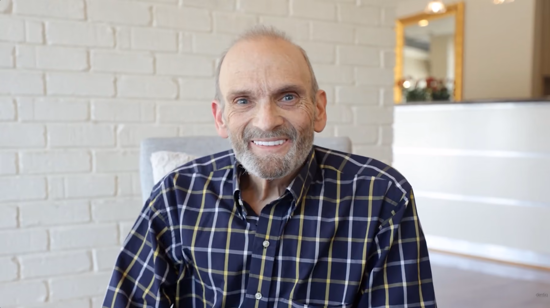 Mike, zygomatic implant patient at Dentiq Dentistry in Houston, TX
