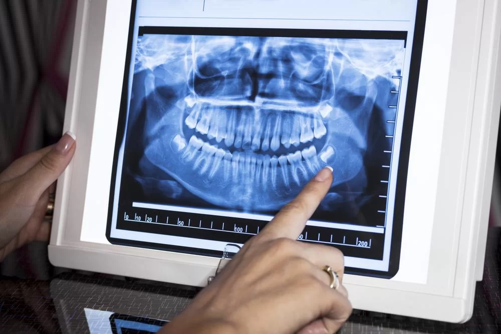 Low-radiation digital X-ray equipment at Dentiq Dentistry Houston