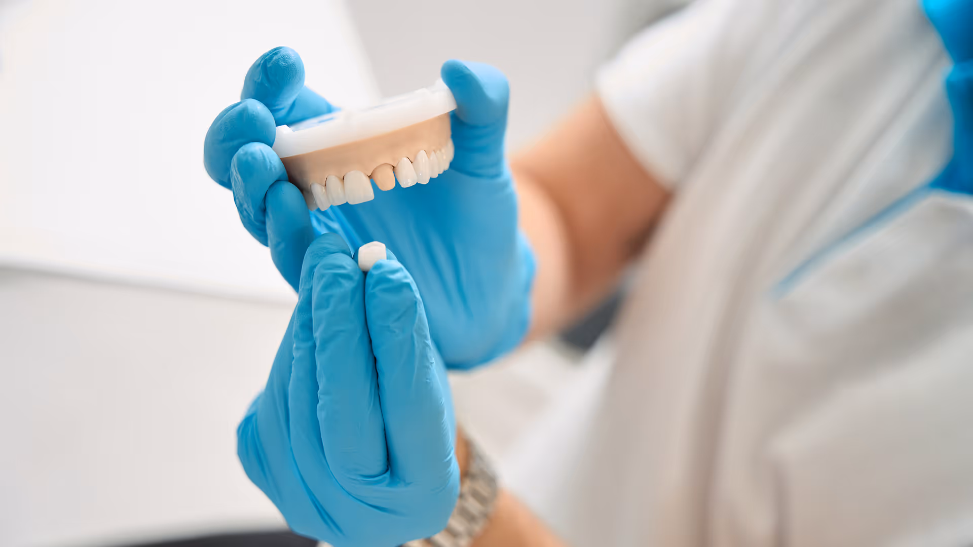 Dental crowns in Houston, TX at Dentiq Dentistry