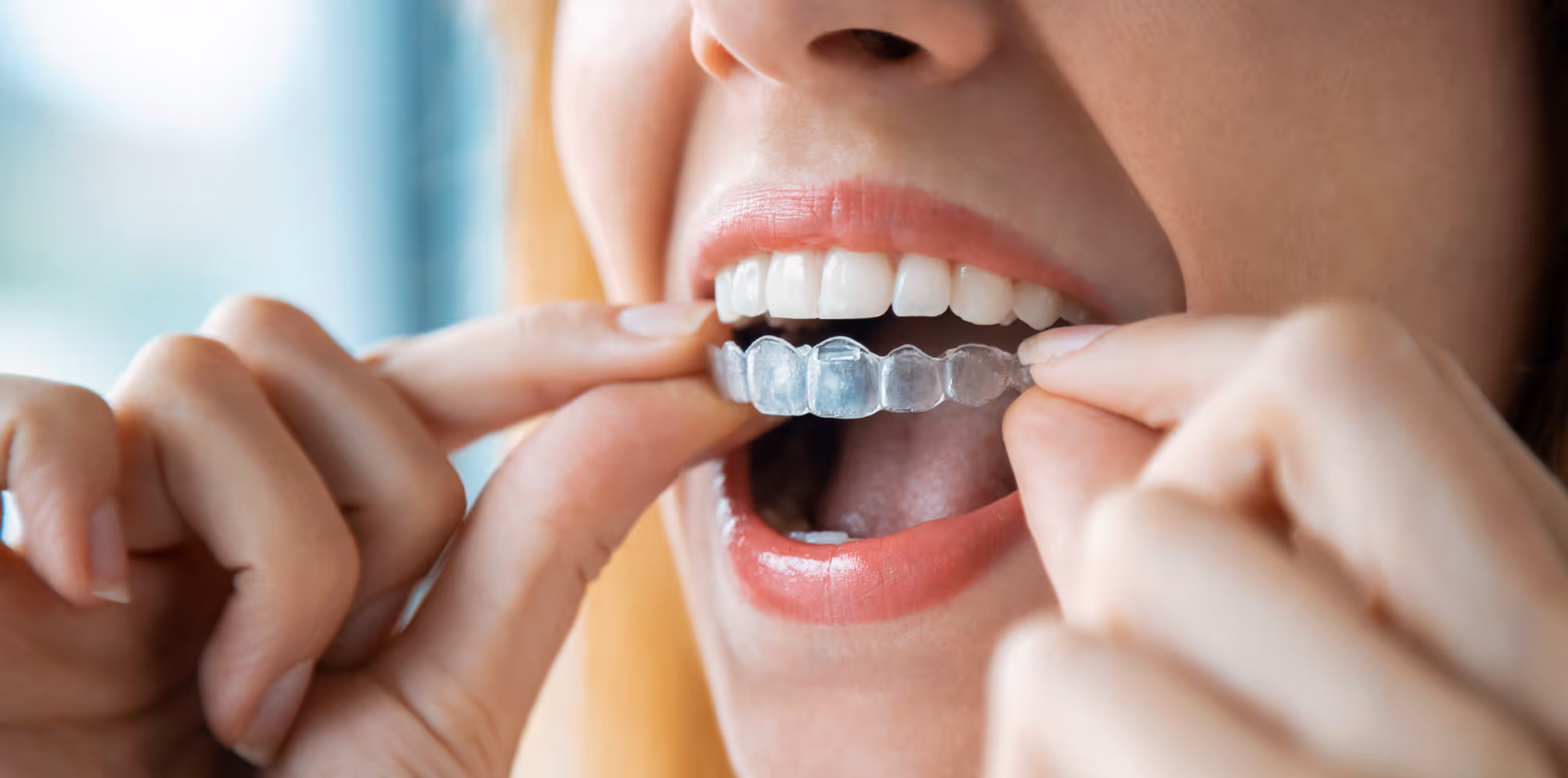 Patient holding Invisalign clear aligners at Dentiq Dentistry in Houston, TX