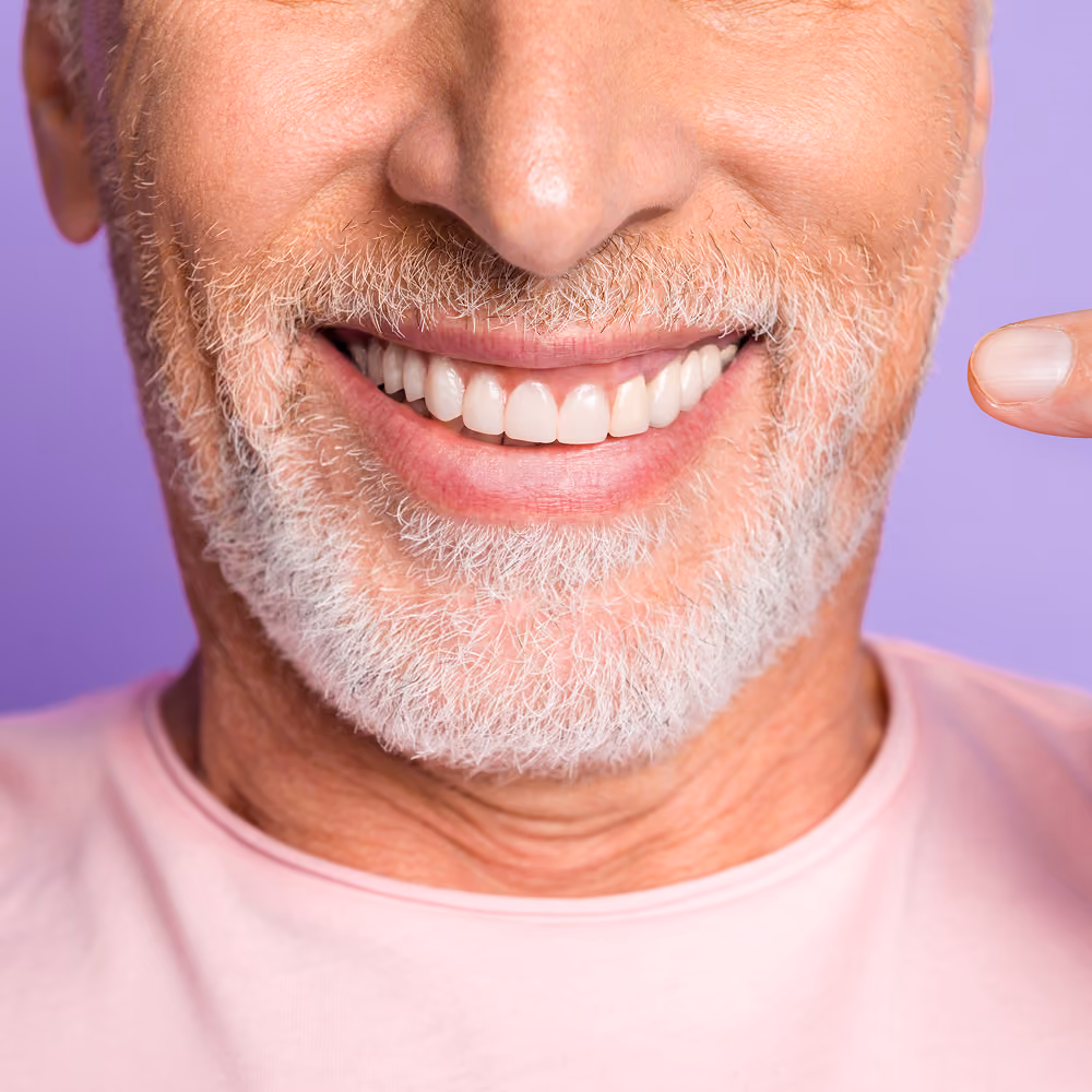 All-On-4 dental implant model showing a full arch supported by four implants at Dentiq Dentistry Houston