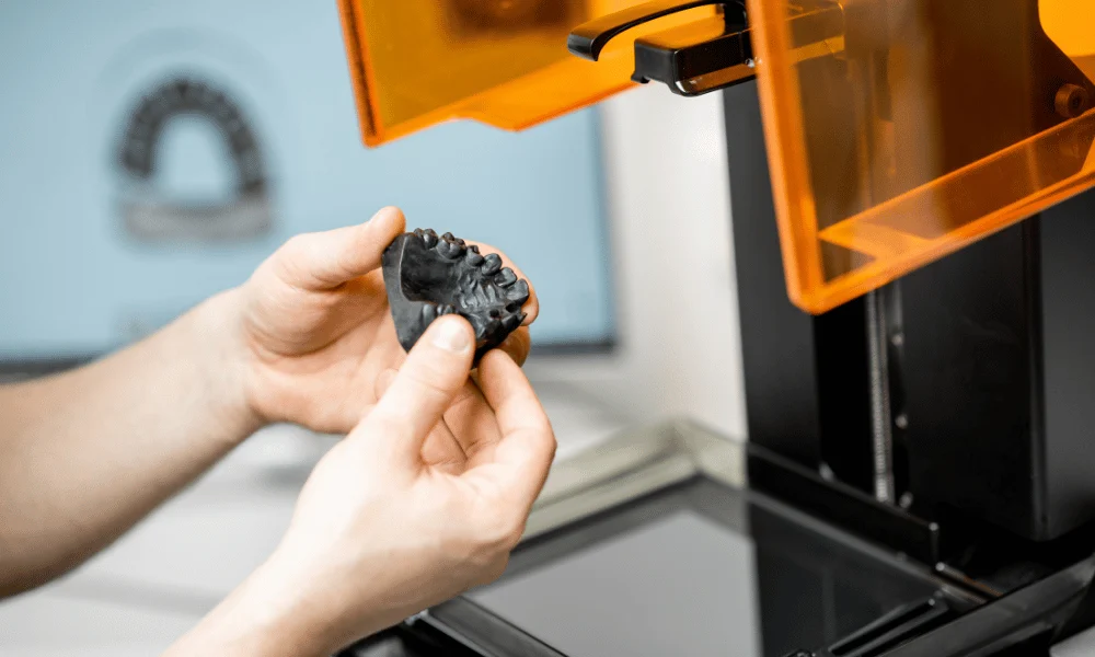 3D printed dental model used to plan implant treatment in Houston