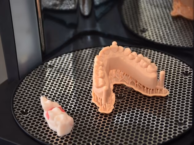 Denture designed with computer-aided software before 3D printing in Houston