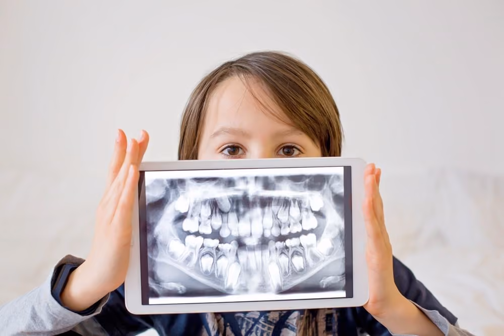 Digital dental X-ray image displayed on a screen during a Houston exam