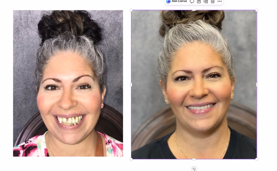 Before and after cosmetic smile refinement, Dentiq Dentistry Houston