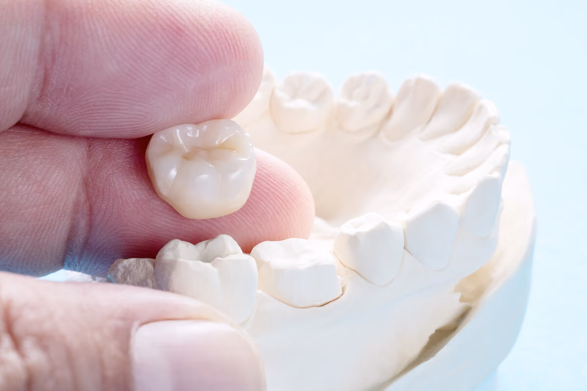 Dental crown patient at Dentiq Dentistry Houston