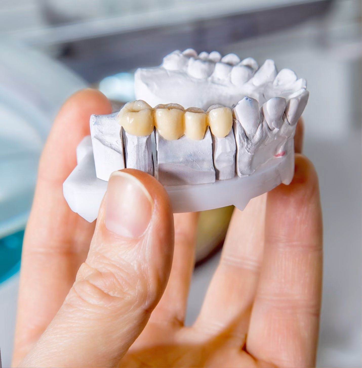 Dental bridge patient at Dentiq Dentistry Houston