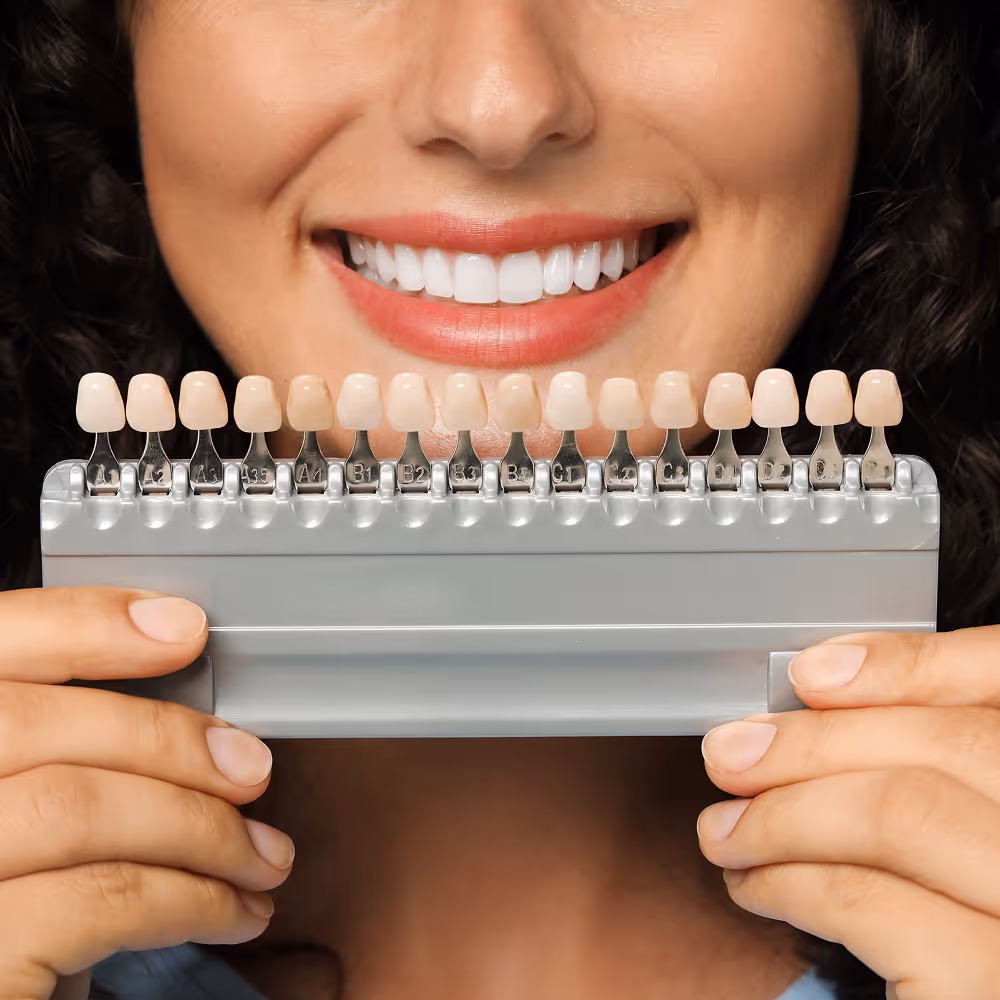 Before and after porcelain veneers at Dentiq Dentistry Houston