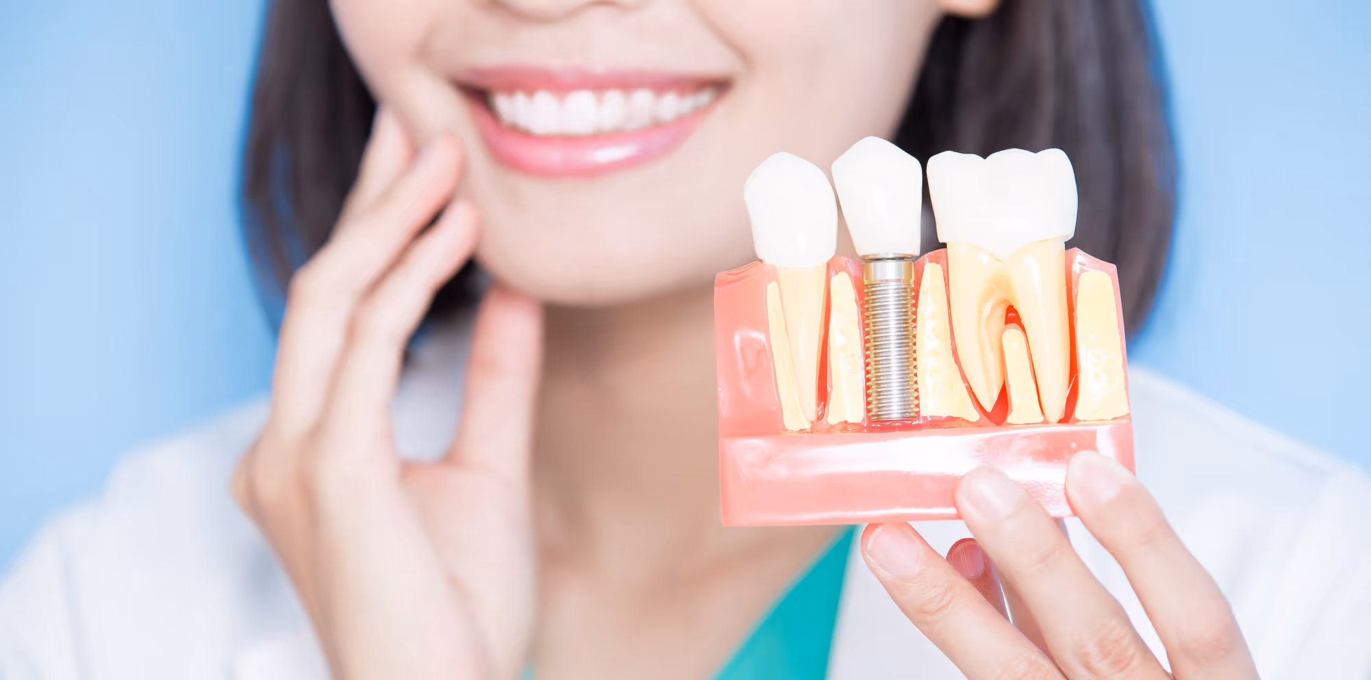 Dental implant treatment at Dentiq Dentistry in Houston, TX
