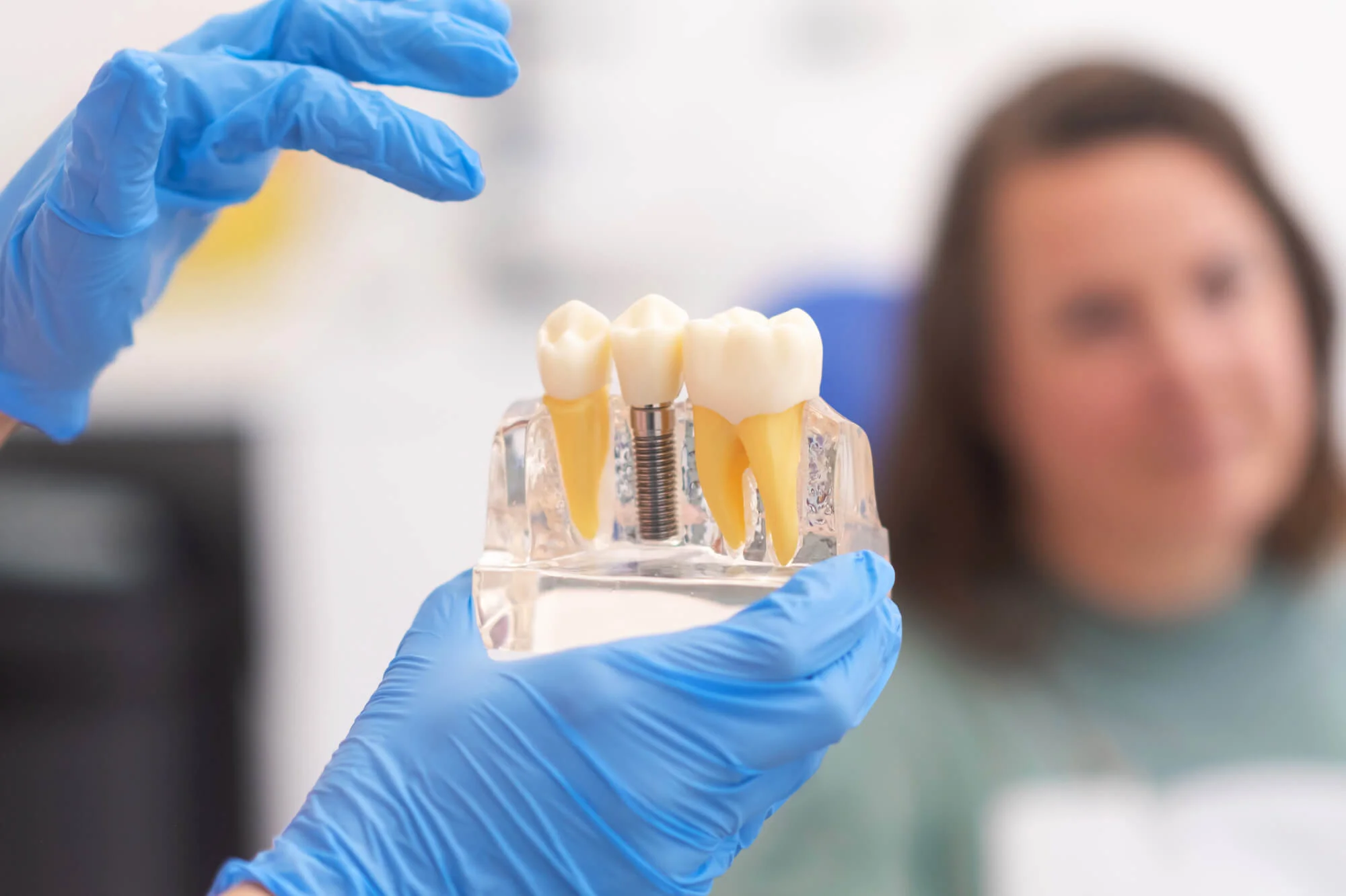 dentist holding model of a dental implant and showing it to a dentist