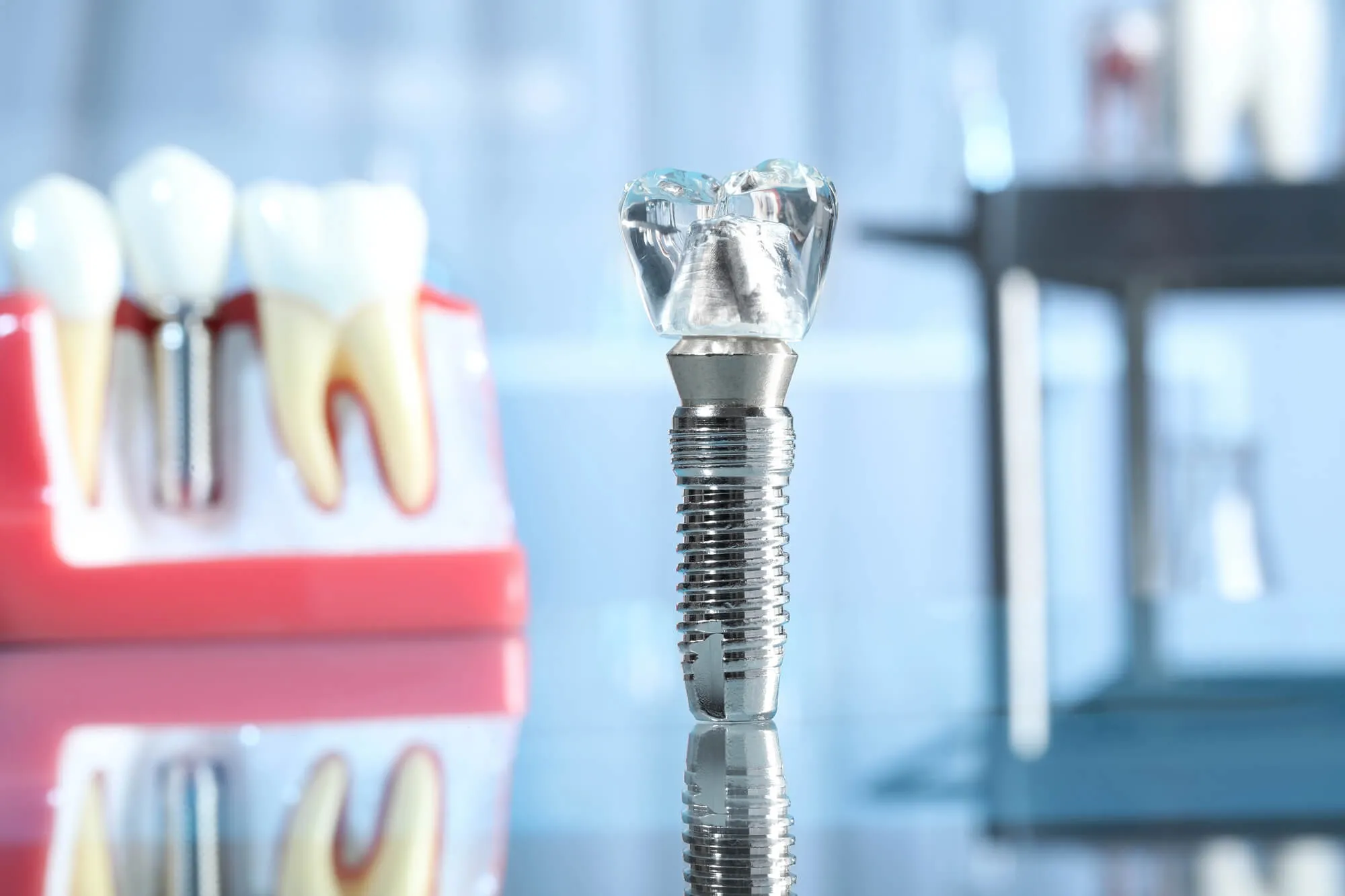 model of a dental implant