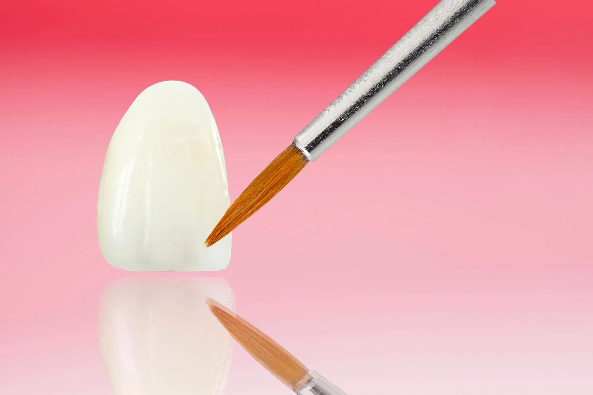 porcelain veneers
