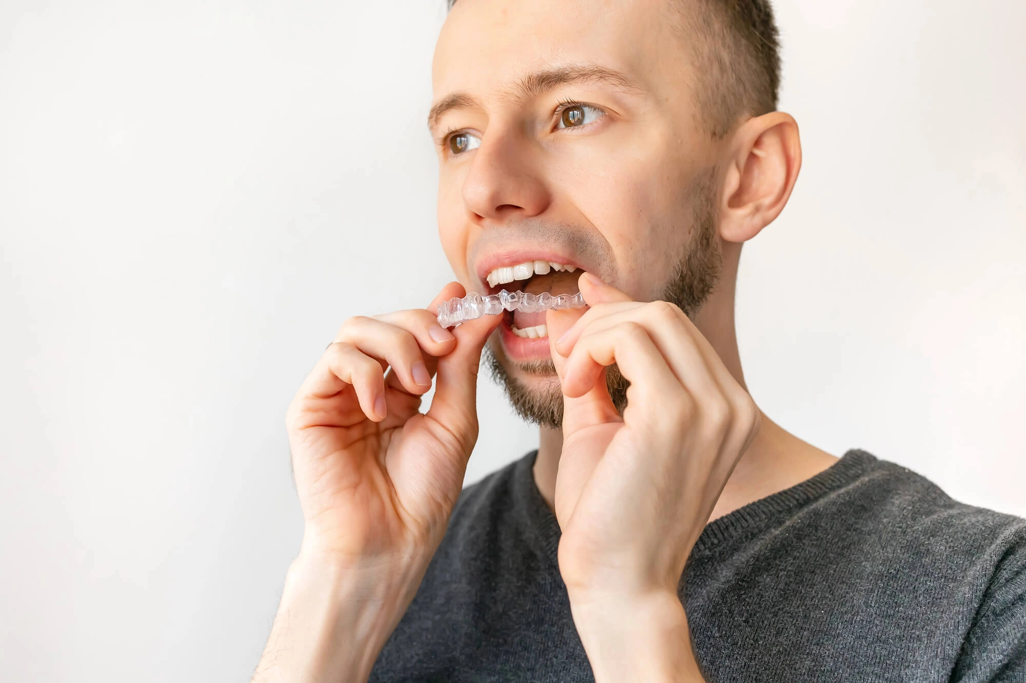 man putting on his aligners