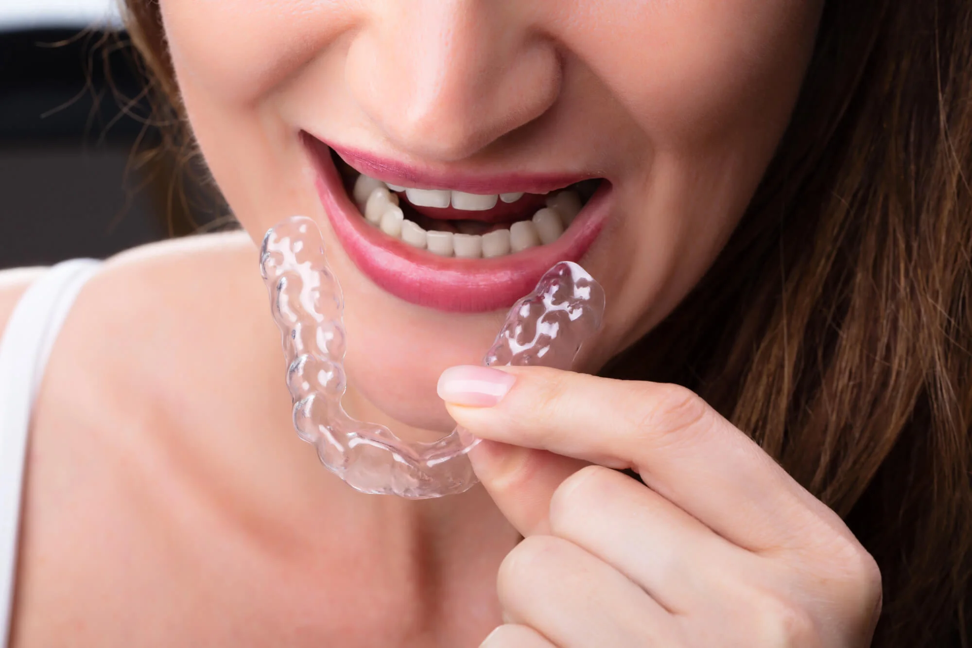 woman putting on her aligners