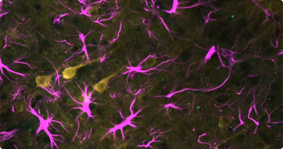 A pink and green fluorescent microscopy image of multiple neural cells.