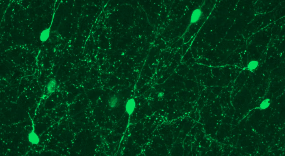 A fluorescent green microscopy image of neural cells.