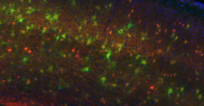 A red and green microscopy image of neural cells.