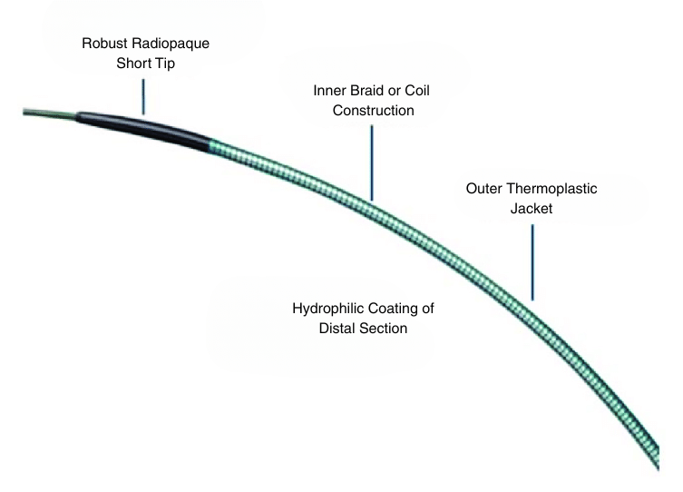 Microcatheter pathway from the descending aorta through the aortic arch into the left common carotid artery