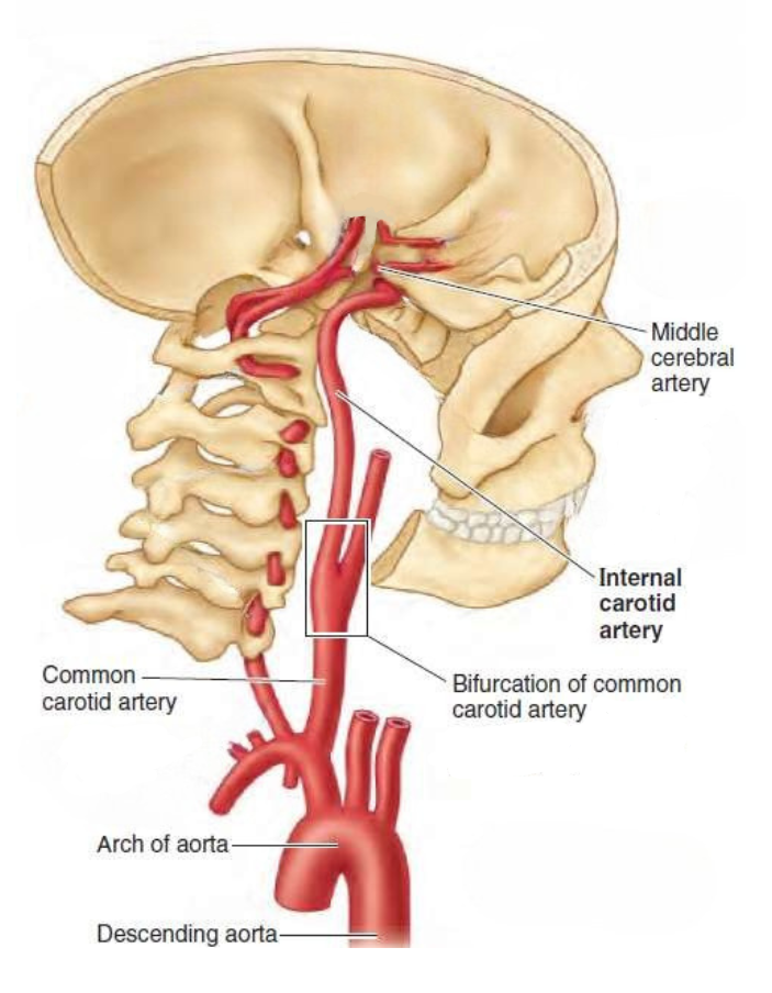 Bifurcation of the middle cerebral artery, a sharp branching point that challenges device advancement