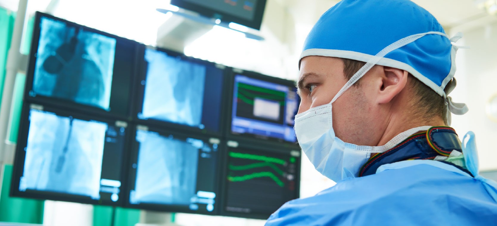 Cardiac catheterization lab team performing a coronary angioplasty, with live fluoroscopic images of the heart displayed on a large monitor overhead.