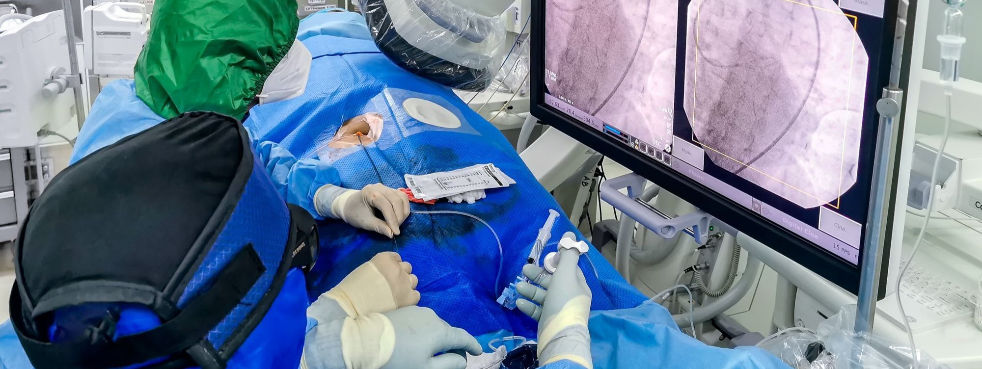 Cardiac catheterization lab team performing a coronary angioplasty, with live fluoroscopic images of the heart displayed on a large monitor overhead.