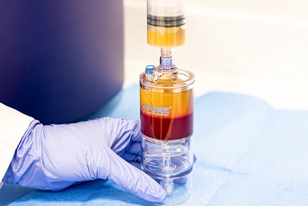 PurePRP SP PRP concentrating system