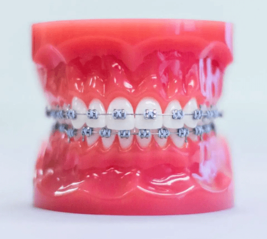 Comprehensive Braces