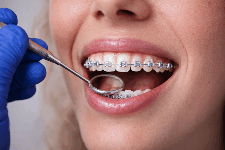 Do Braces Hurt?