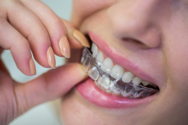 Does Invisalign Hurt?