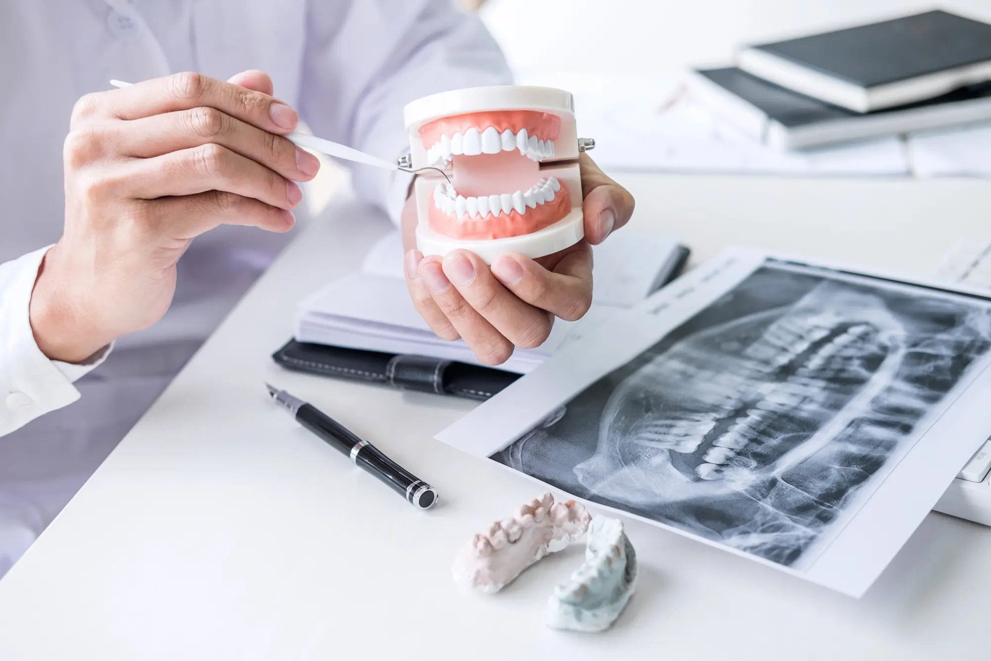 Dentist's hands holding a dental model and a dental tool with dental x-rays, molds, and stationery on a white desk.