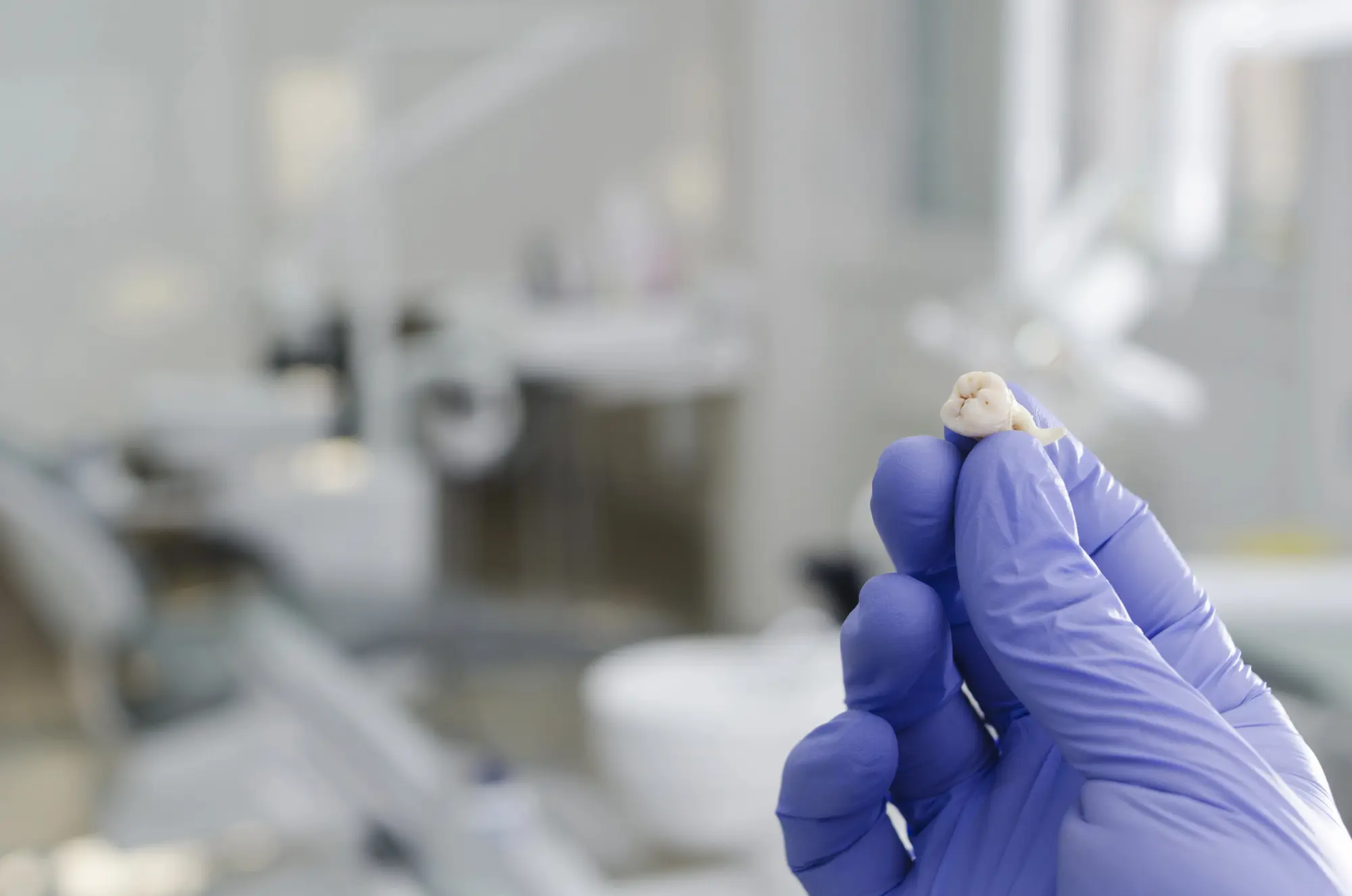 Hand wearing a purple glove holding an extracted tooth in a dental clinic setting.