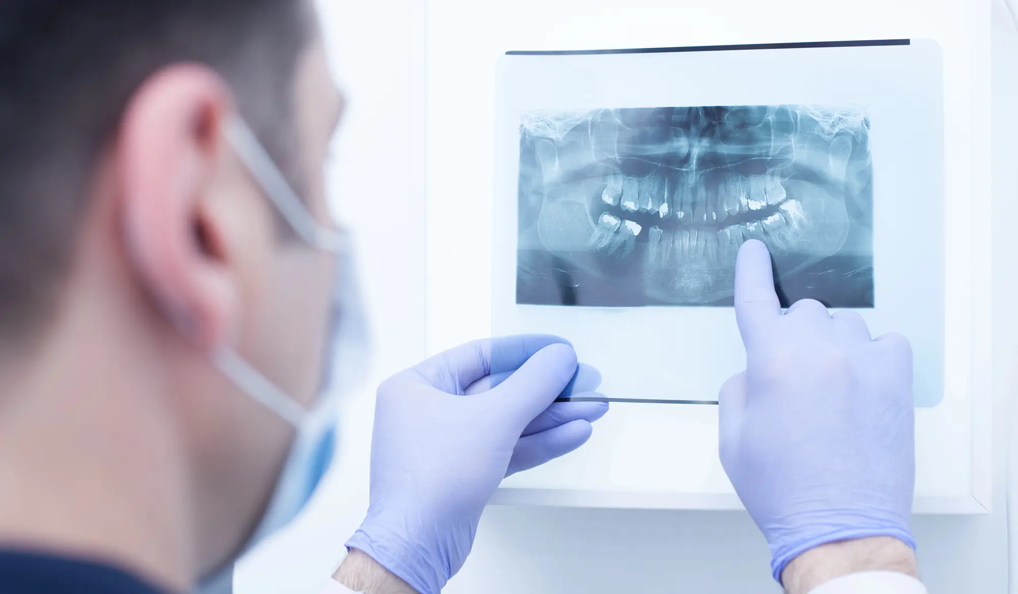 Dentist wearing gloves and mask examining a dental X-ray image showing teeth and jaw structure.