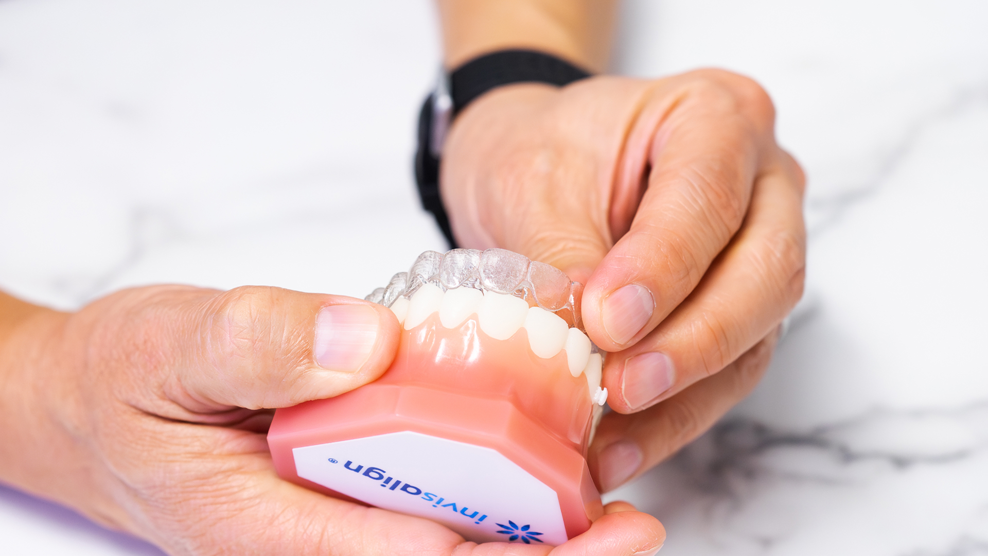 invisalign-point-loma-san-diego