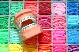 Dental model with braces in front of trays of colorful elastic bands