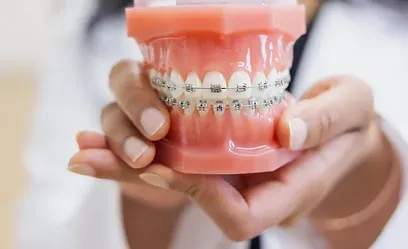 Orthodontist holding a dental model with metal braces