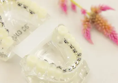 Clear dental models showing BRAVA hidden braces behind the teeth