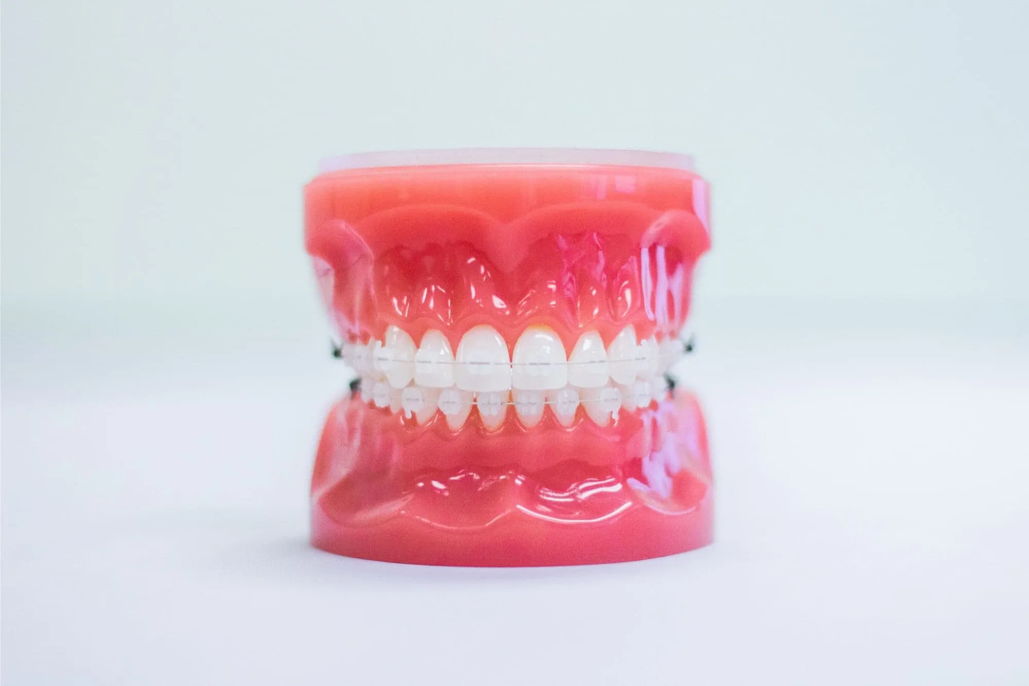 Dental model with clear ceramic braces and archwire on a white background at Bond Orthodontics in Northbrook IL.