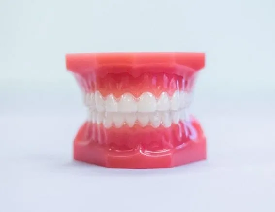 Dental model wearing a clear removable aligner on a white background.