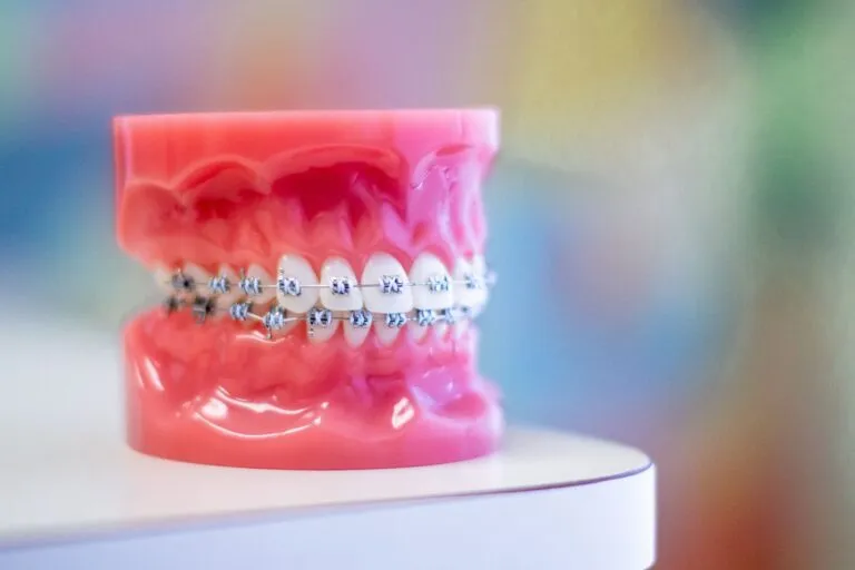 Dental model with metal braces in front of a colorful blurred background.