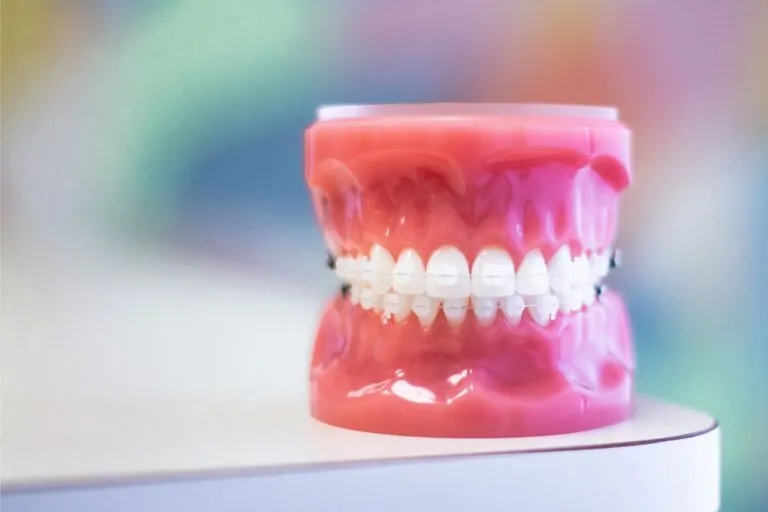 Dental model with clear braces in front of a colorful blurred background.