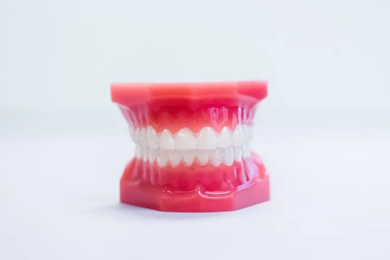 Dental model wearing a clear aligner on a white background.