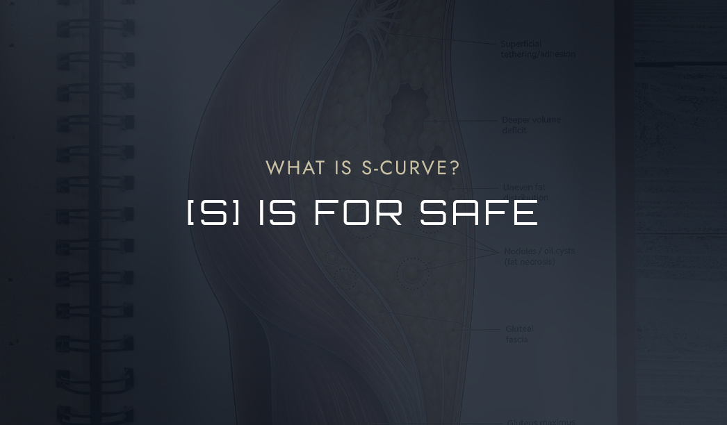 The S in S-Curve Also Stands for Safe