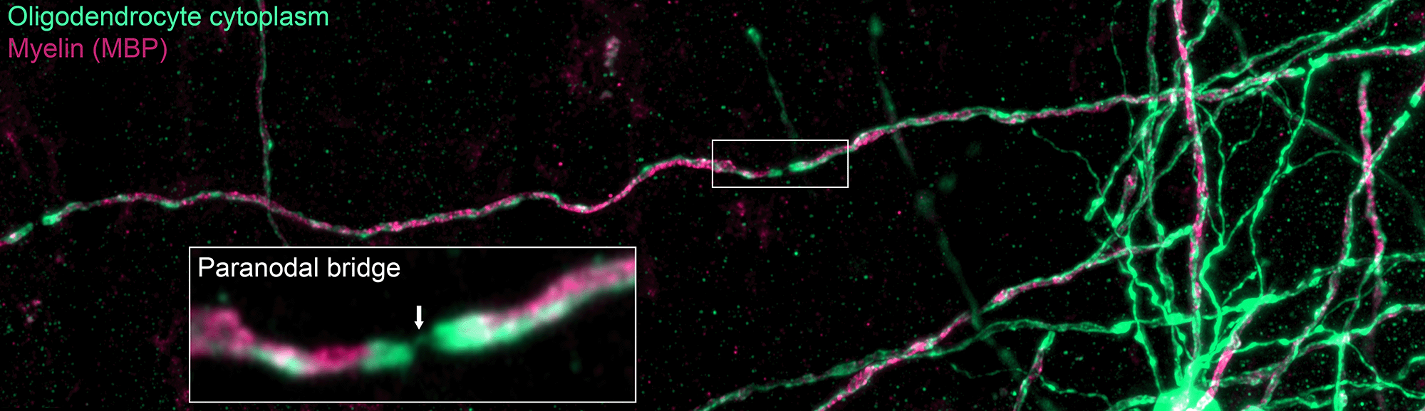 Confocal image of a cortical axon showing oligodendrocyte cytoplasm in green and myelin basic protein in magenta, with an inset highlighting a paranodal bridge — a thin cytoplasmic process connecting two myelin sheaths across a node.