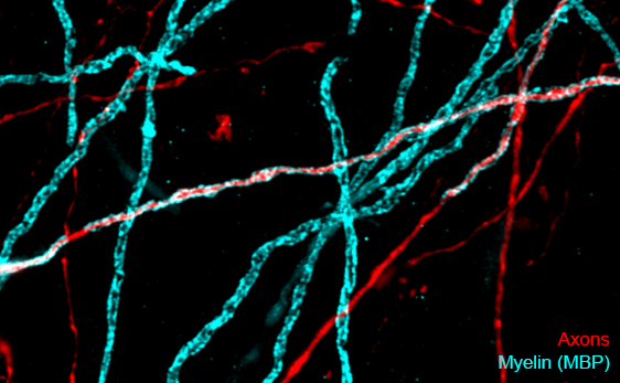 Confocal image of cortical tissue with axons labelled in red and myelin basic protein in cyan, showing that some axon segments are wrapped in myelin while neighbouring stretches are left bare.
