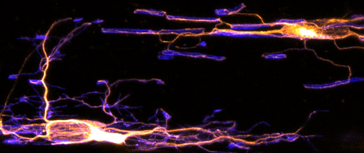 Fluorescence image of the zebrafish spinal cord showing an oligodendrocyte with orange-labelled processes extending among blue myelin sheaths along axons.