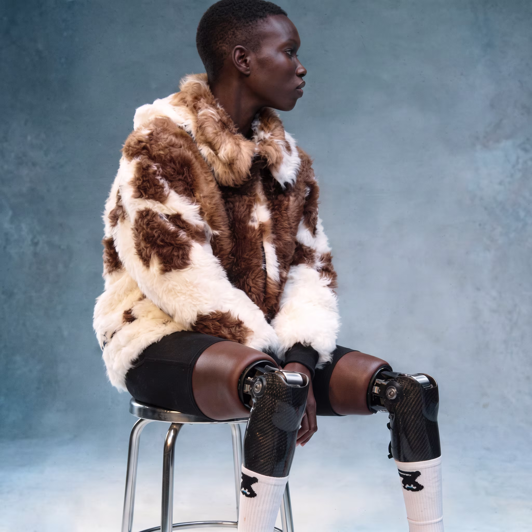 Side view of person with prosthetic legs wearing a brown and white fur jacket sitting on a stool.