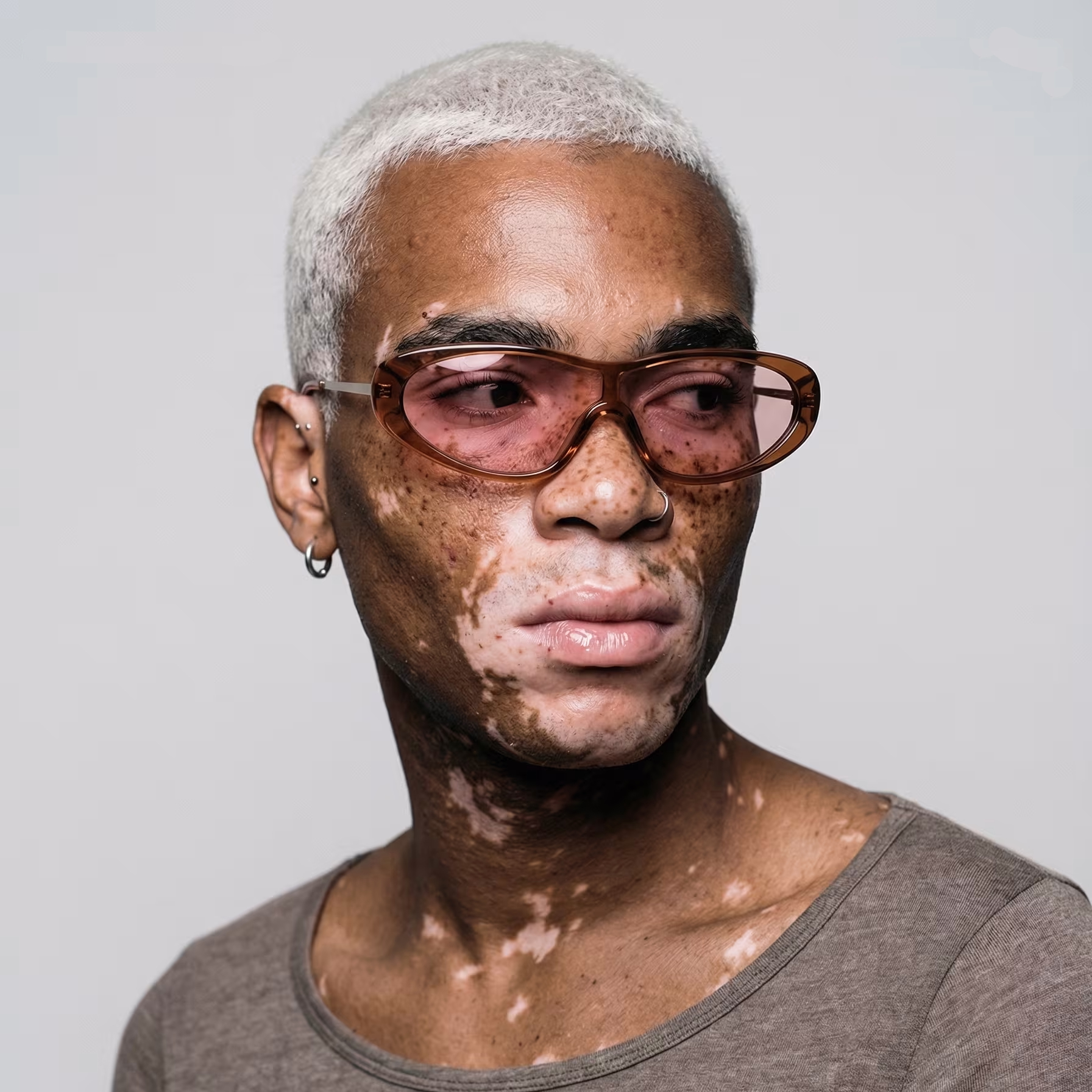 Person with vitiligo, short white hair, wearing pink tinted sunglasses and a gray shirt, looking to the side.