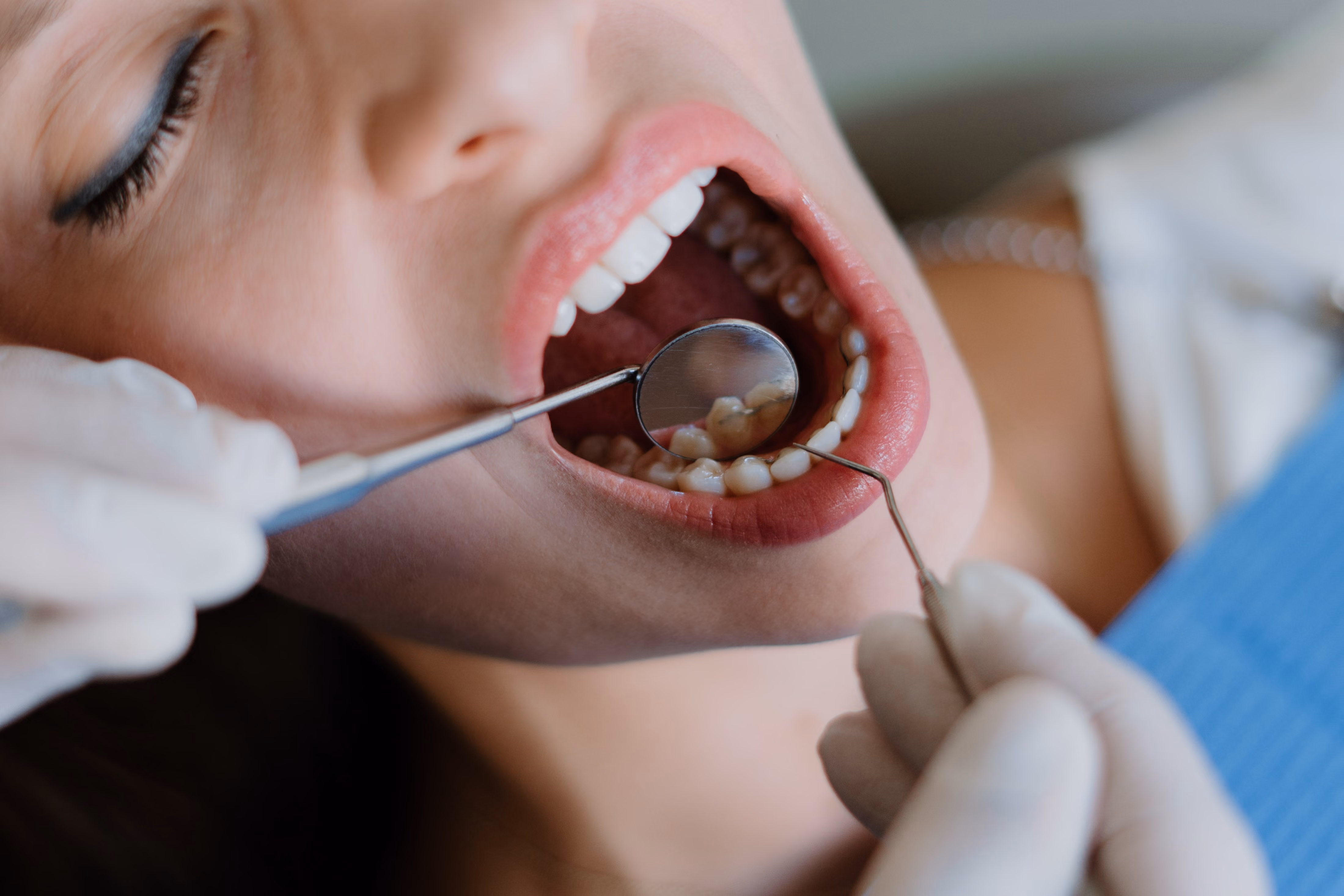 Nahaufnahme einer offenen Mundhöhle mit Zahnuntersuchungsinstrumenten und weißen Zähnen.