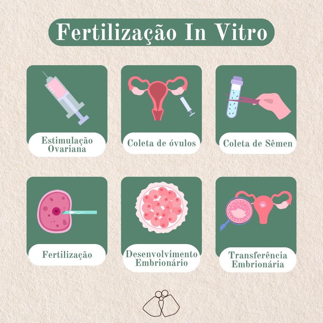 Infográfico das etapas da fertilização in vitro: estimulação ovariana, coleta de óvulos e sêmen, fertilização, desenvolvimento e transferência embrionária